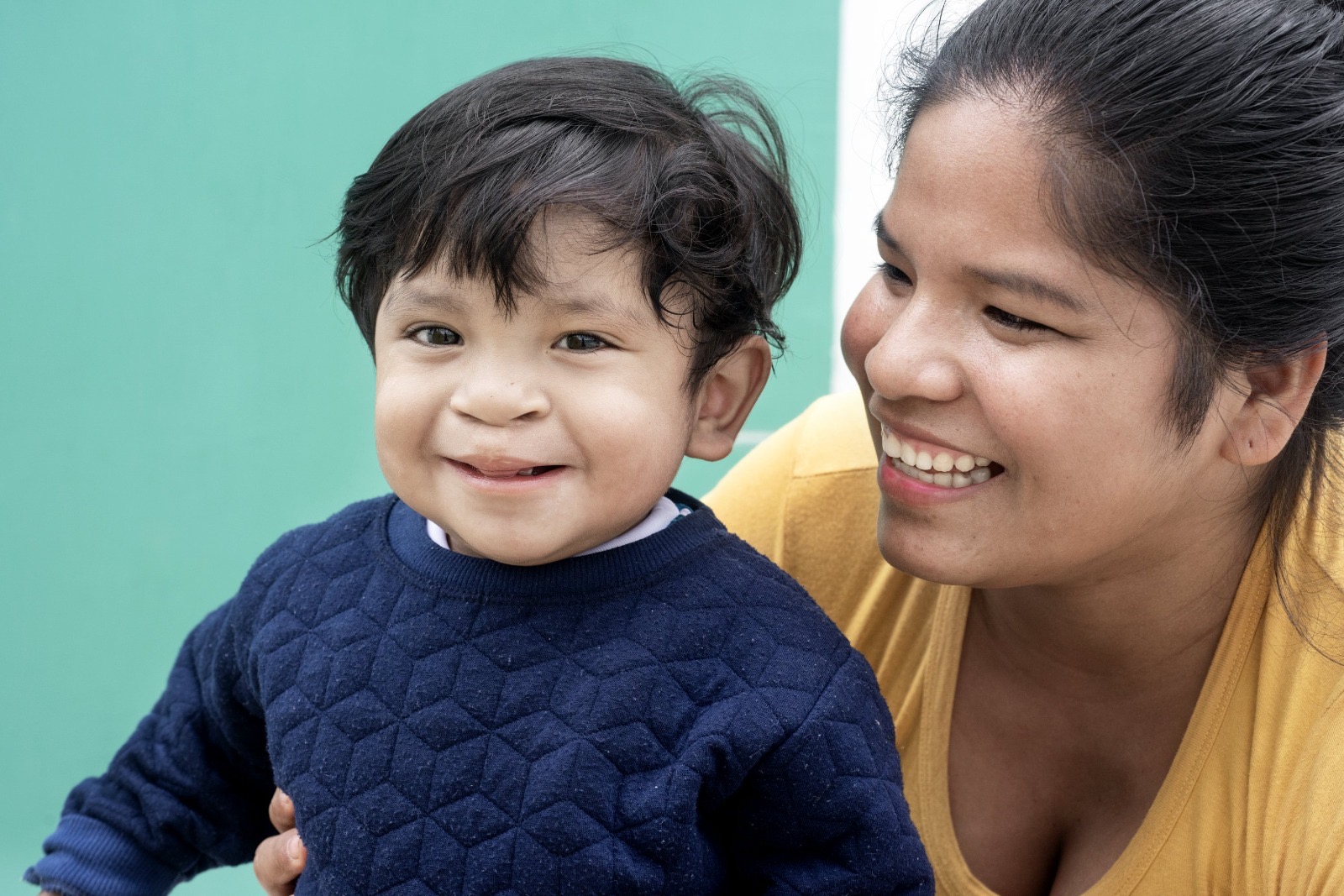 Operación Sonrisa lanza “Rifa Solidaria” para financiar tratamiento integral a pacientes con fisura labial y paladar hendido